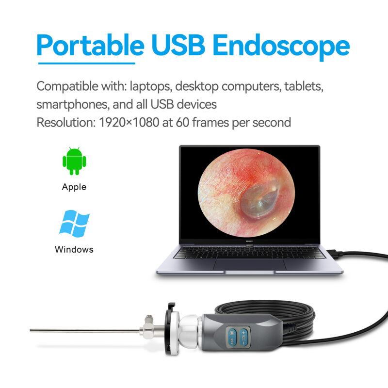 Portable endoscopy camera