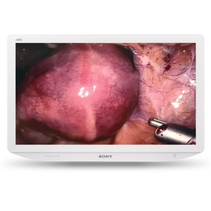 Sonly 4k medical grade monitor