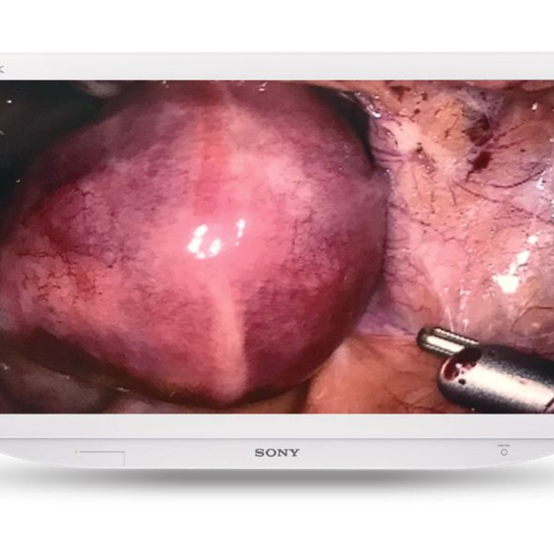 Sonly 4k medical grade monitor