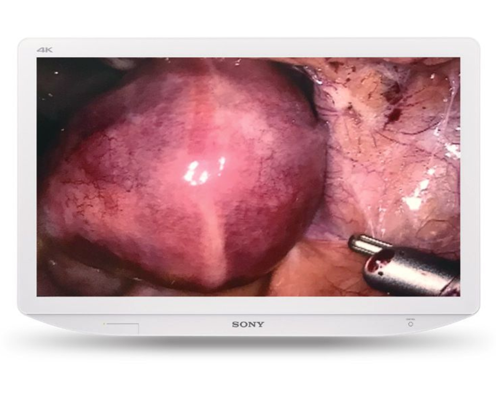 Sonly 4k medical grade monitor